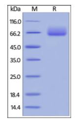 Human B7-1, Fc Tag (HPLC-verified) on SDS-PAGE under reducing (R) condition. The gel was stained overnight with Coomassie Blue. The purity of the protein is greater than 95%.